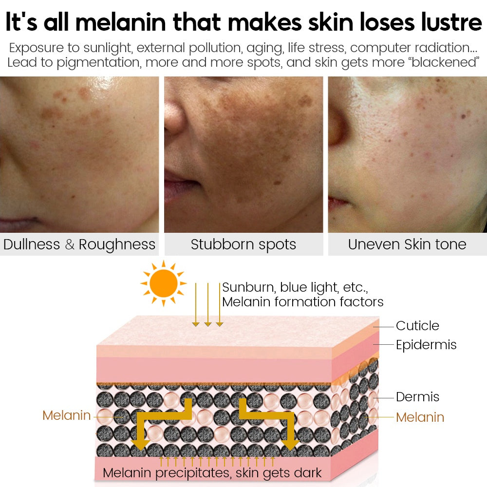 VIBRANT GLAMOUR FDA Vitamin C Cream Fading Dark Spots Reduce Melasma
