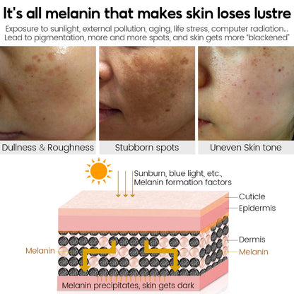VIBRANT GLAMOUR FDA Vitamin C Cream Fading Dark Spots Reduce Melasma