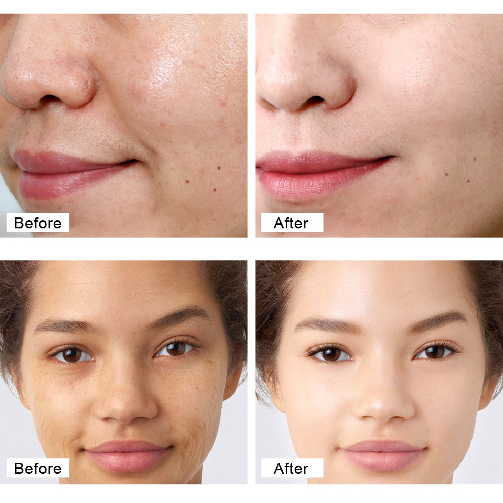 VIBRANT GLAMOUR FDA Natural Retinol Cream Face Anti-Aging Wrinkles Anti-Freckles Moisturizer 30g
