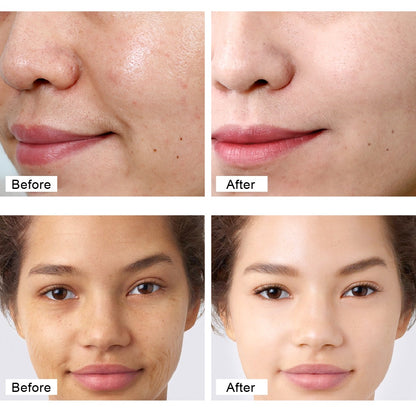 VIBRANT GLAMOUR FDA Natural Retinol Cream Face Anti-Aging Wrinkles Anti-Freckles Moisturizer 30g