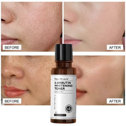 VIBRANT GLAMOUR α-Arbutin Whitening Toner Niacinamide Reduce Dark Spots Freckles Pigmentation Facial Moisturizer 100ml
