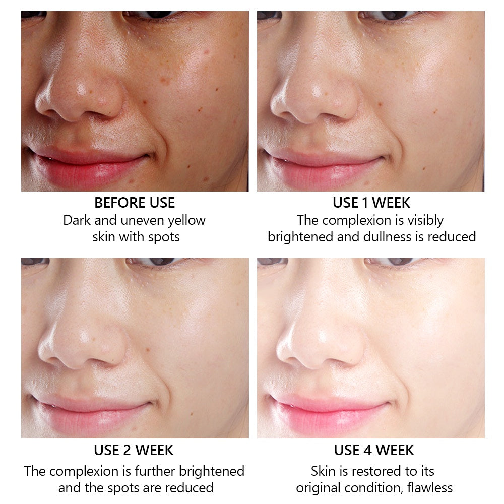 VIBRANT GLAMOUR FDA Vitamin C Whitening Face Cream + Face Serum Sets Fading Dark Spot Freckles Brightening VC Essence