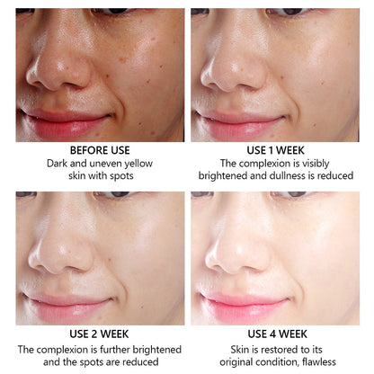VIBRANT GLAMOUR FDA Vitamin C Whitening Face Cream + Face Serum Sets Fading Dark Spot Freckles Brightening VC Essence